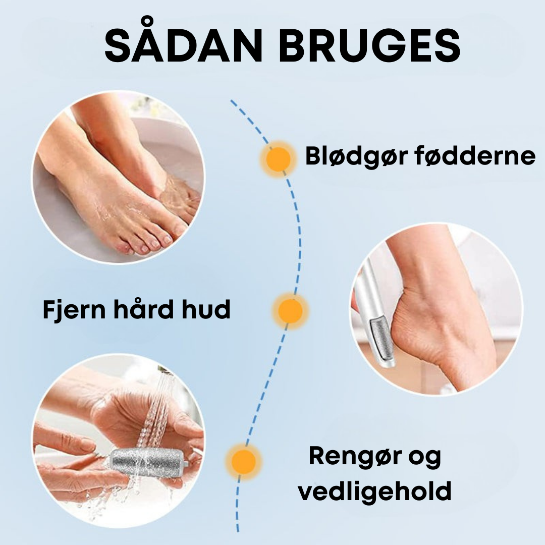 Fodsliber | Babybløde fødder – elektrisk hårdhudsfjerner