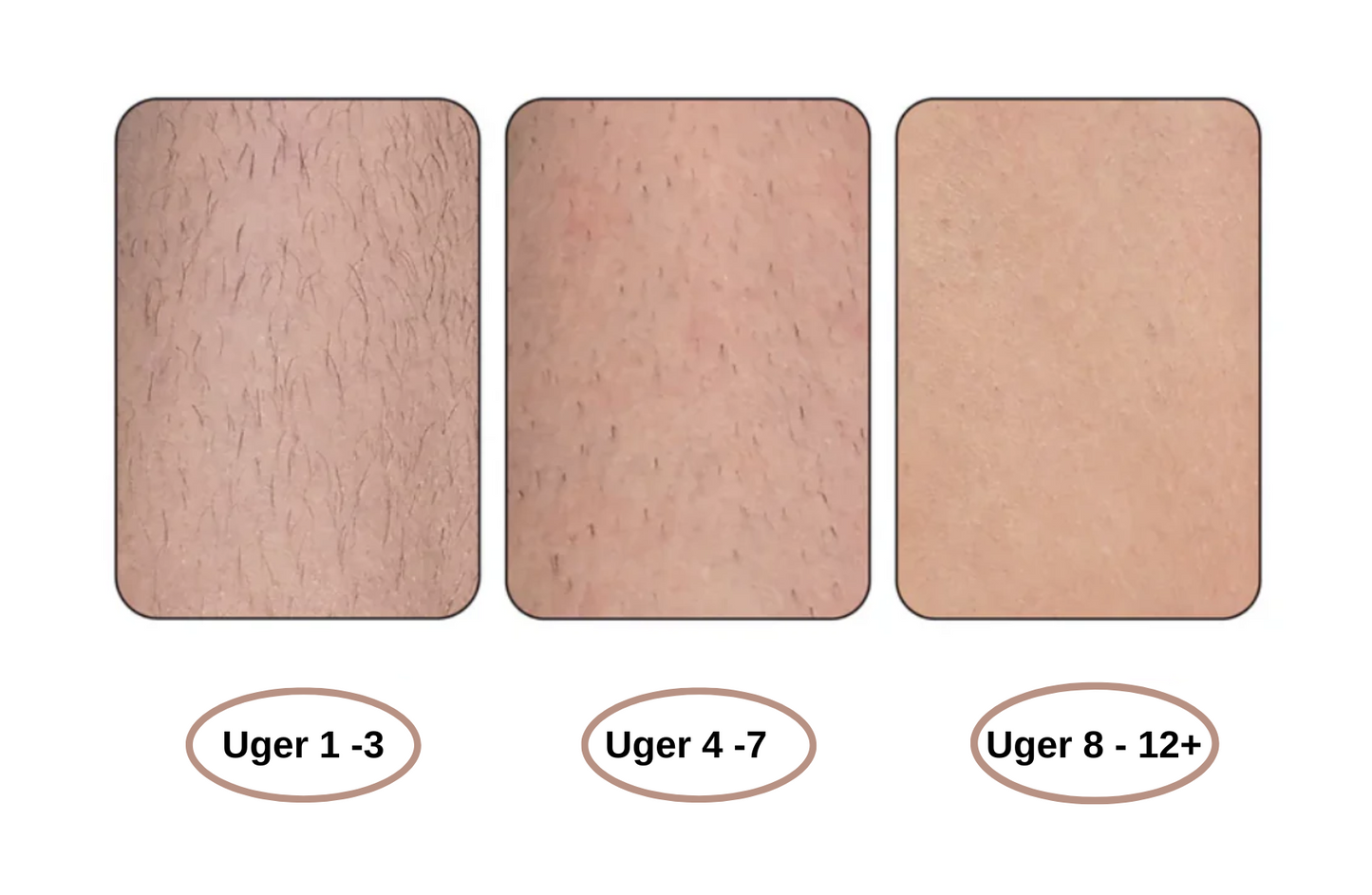 FløjlsHud permanent hårborttagning - ikke mere barbering eller voksning!