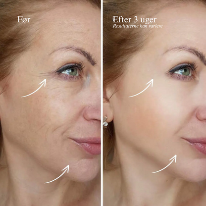 24K Goldskin anti-aging serum