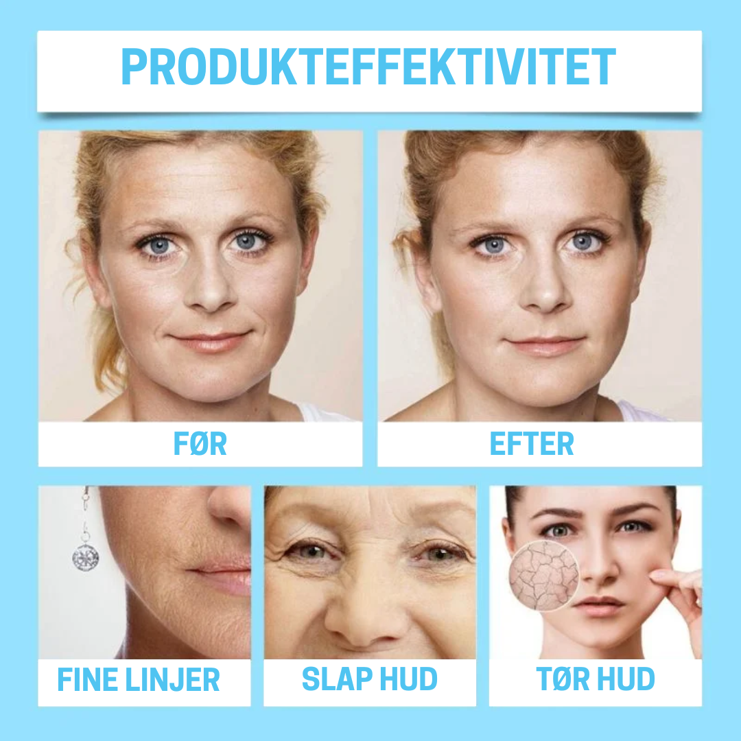 OuHoe Botox