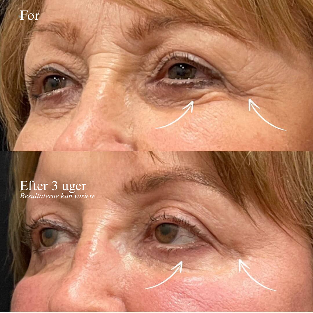 24K Goldskin anti-aging serum