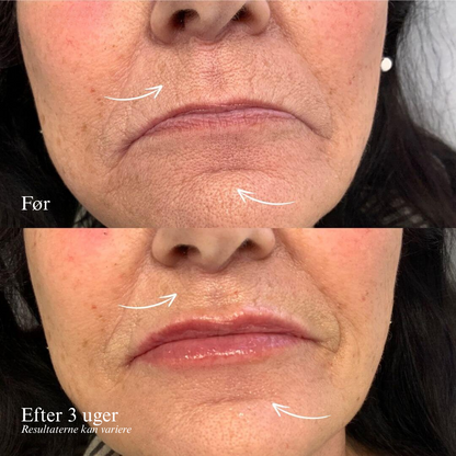 24K Goldskin anti-aging serum