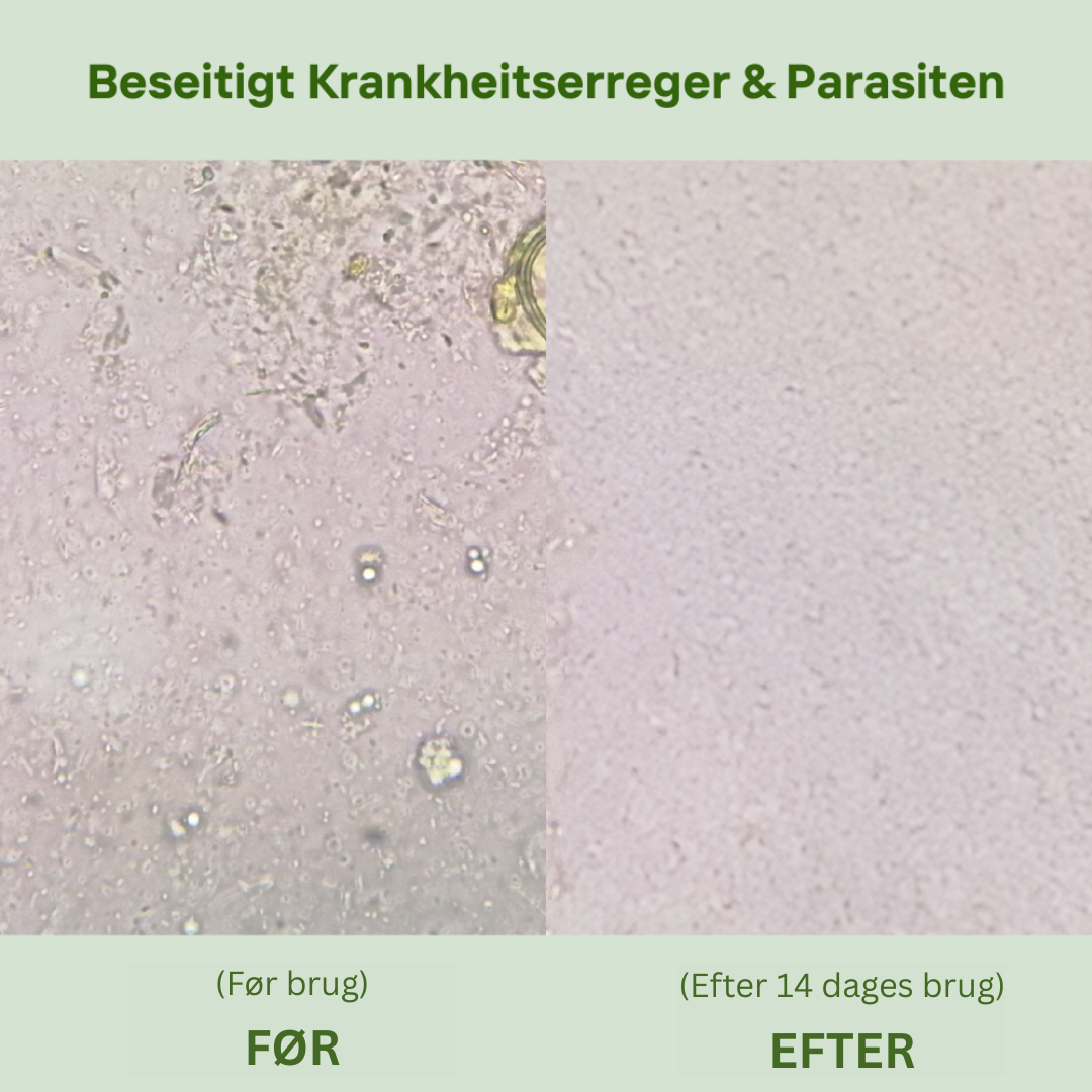 Oil of Oregano - softgels kosttilskud