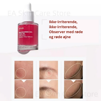 Anua - Dark spot serum