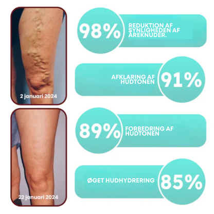 ÅreRo® - Åreknudeplaster