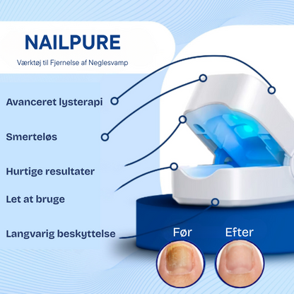NailPure | Værktøj til Fjernelse af Neglesvamp